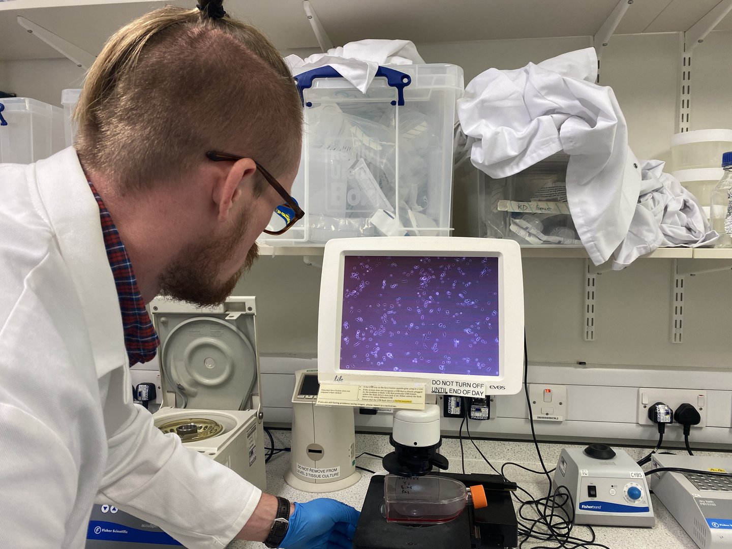 A scientist in a lab coat looks at a monitor showing magnified neuroblastoma cells, surrounded by lab equipment.