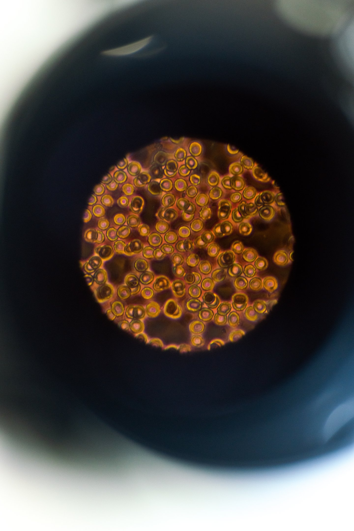 Cells seen through a microscope lens. The cells appear as an orange/gold colour against a brown background.