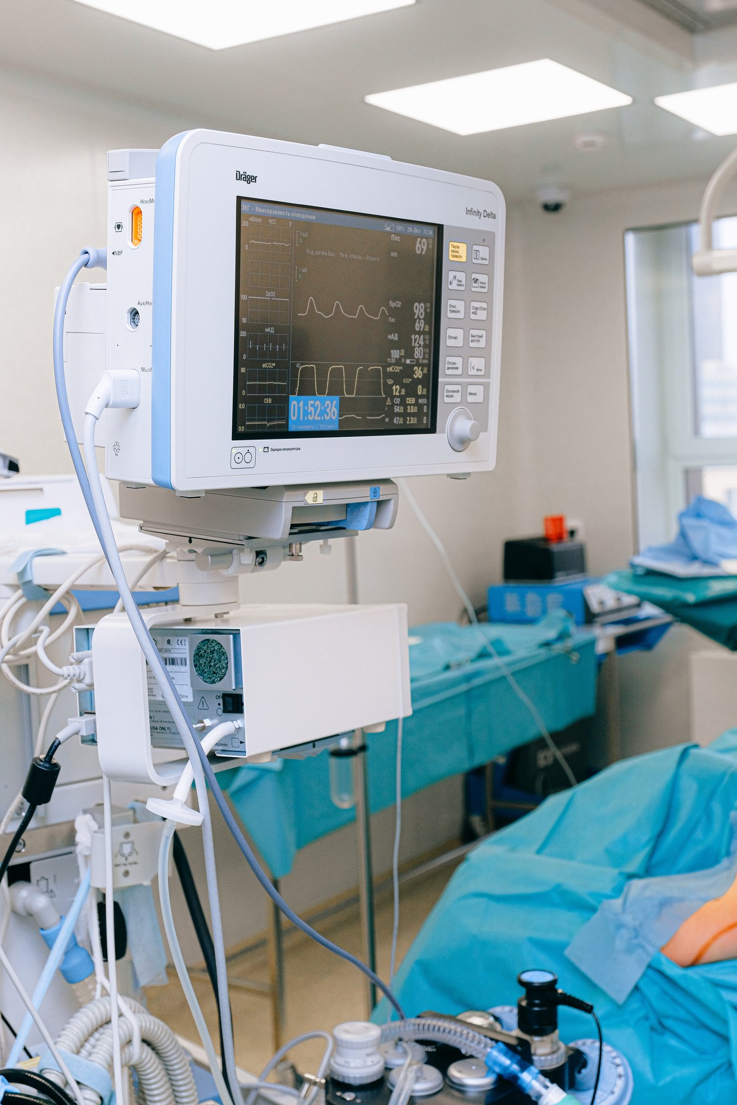 A hospital monitor displaying patient vital signs, including heart rate and oxygen levels, in a brightly lit medical room.